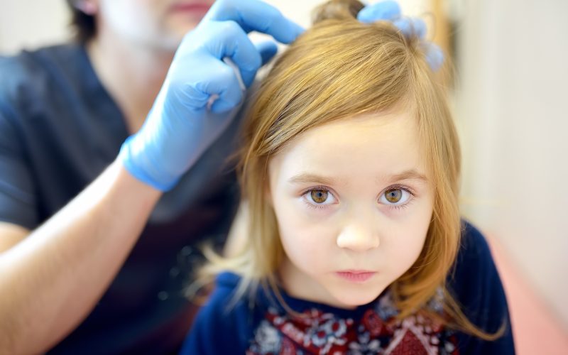 Doctor examines child hair and scalp for lice and nits. Pediculosis is common disease in kids groups